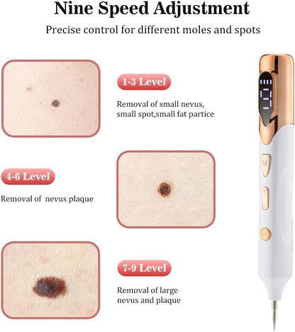 Laser Mole Removal Pen | Plasma Wart, Freckle, Skin Tag & Tattoo Spot Remover Tool | Electric Beauty Skin Care Device