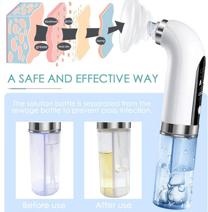 Electric Beauty Pore Cleaner
