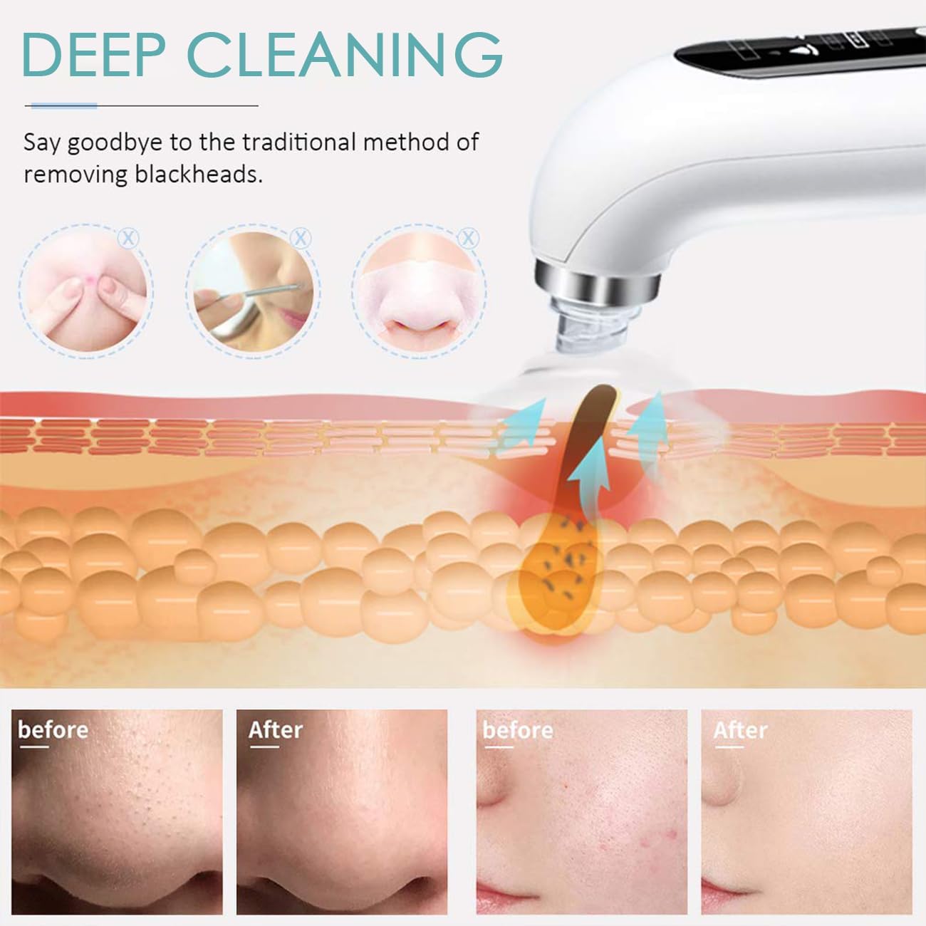 Electric Beauty Pore Cleaner