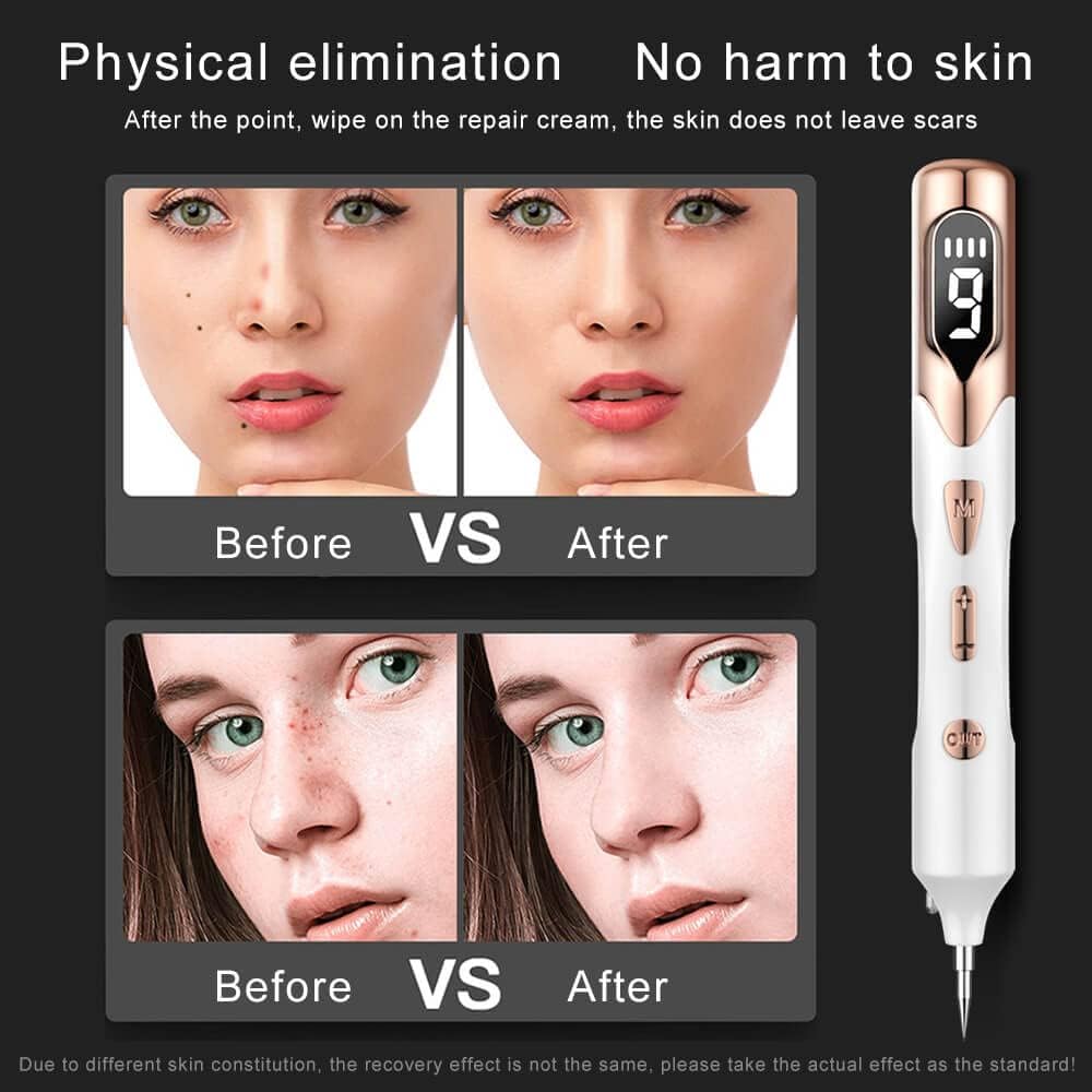 Laser Mole Removal Pen | Plasma Wart, Freckle, Skin Tag & Tattoo Spot Remover Tool | Electric Beauty Skin Care Device