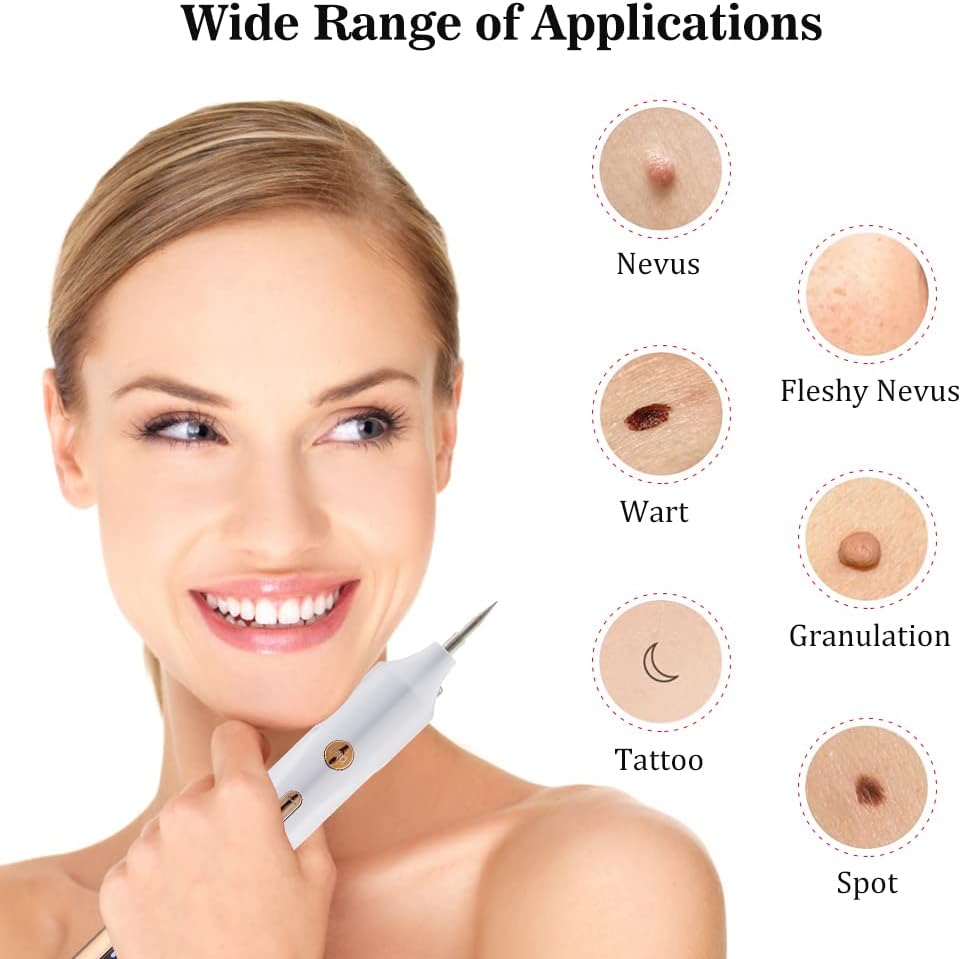 Laser Mole Removal Pen | Plasma Wart, Freckle, Skin Tag & Tattoo Spot Remover Tool | Electric Beauty Skin Care Device