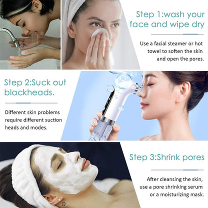 Electric Beauty Pore Cleaner