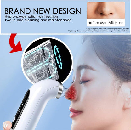 Electric Beauty Pore Cleaner