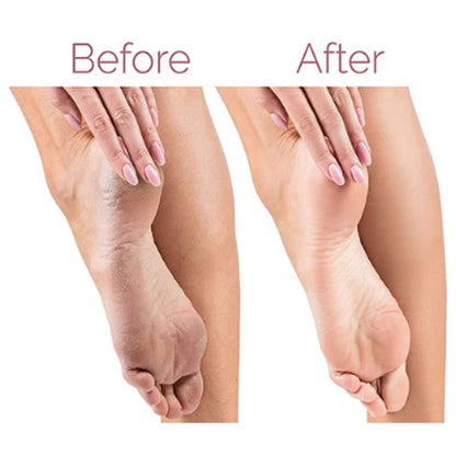 Electric Pedicure Foot File Callus Remover