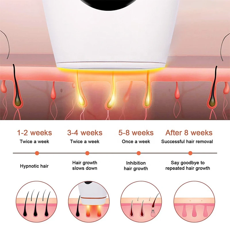 IPL Hair Removal Device for Women