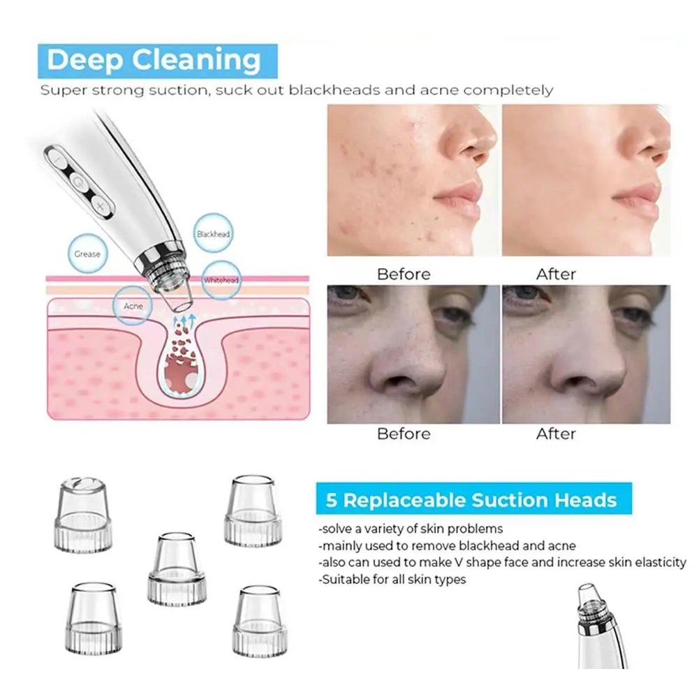 USB Rechargeable Facial Pore Cleaner