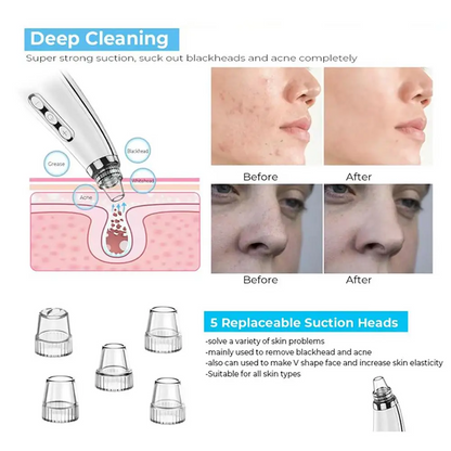 USB Rechargeable Facial Pore Cleaner
