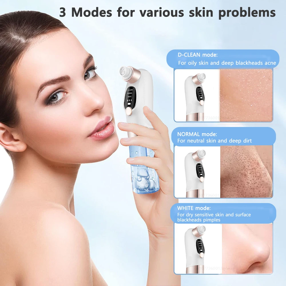 Electric Pore Vacuum | USB Rechargeable | Deep Clean & Gentle Skin Care Tool